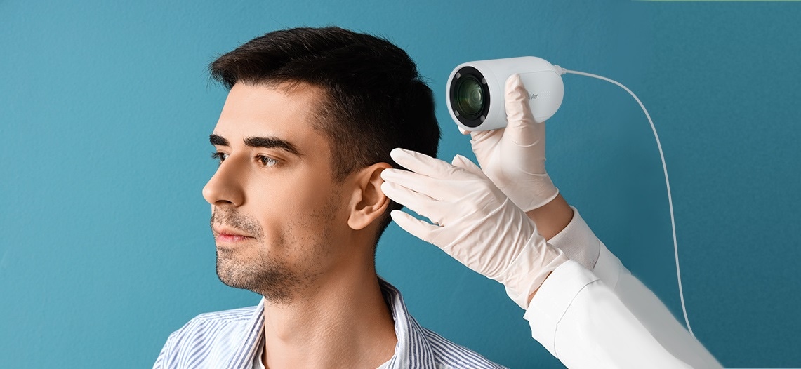 Aver Md330u Thiết Kế độc đáo Đầu Camera Tháo Rời